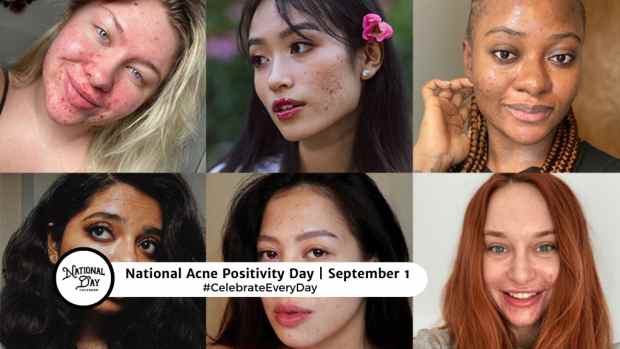 NATIONAL ACNE POSITIVITY DAY | September 1