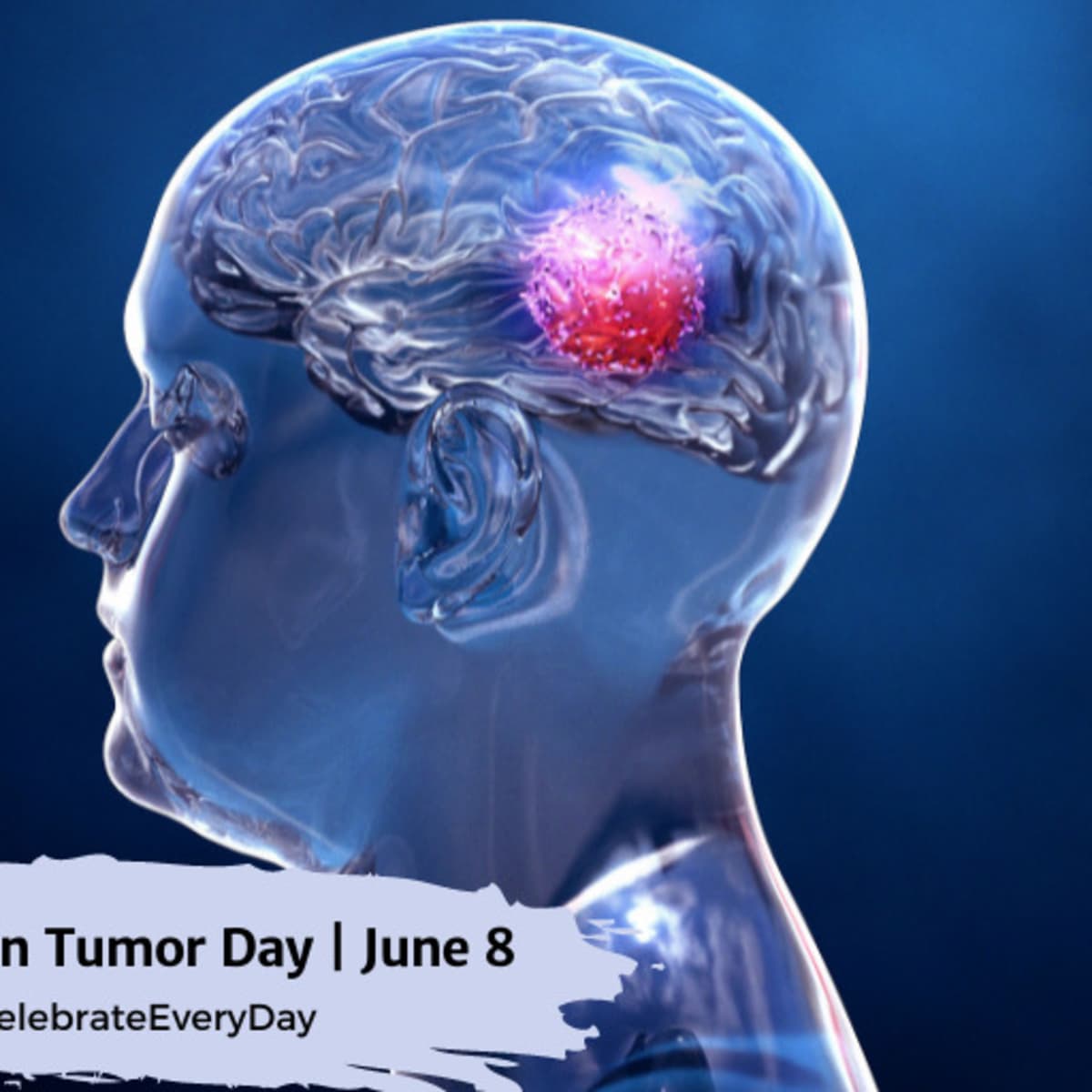 World Brain Tumor Day 