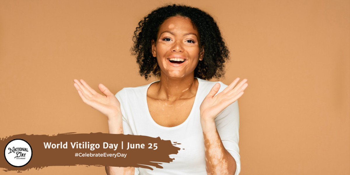 World Vitiligo Day June 25 National Day Calendar 2425