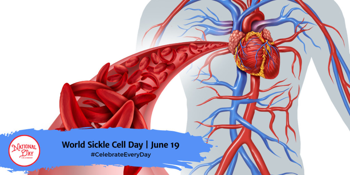 https://www.nationaldaycalendar.com/.image/t_share/MTk5Nzc3NDgyNjU5NDcyNDg3/world-sickle-cell-day--june-19.jpg