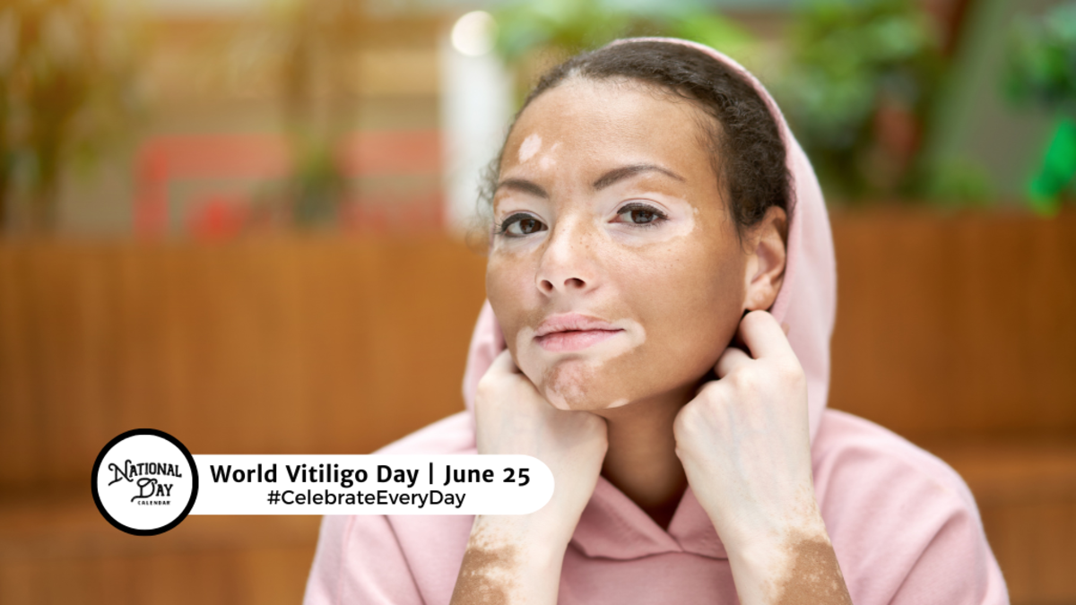 WORLD VITILIGO DAY June 25 National Day Calendar