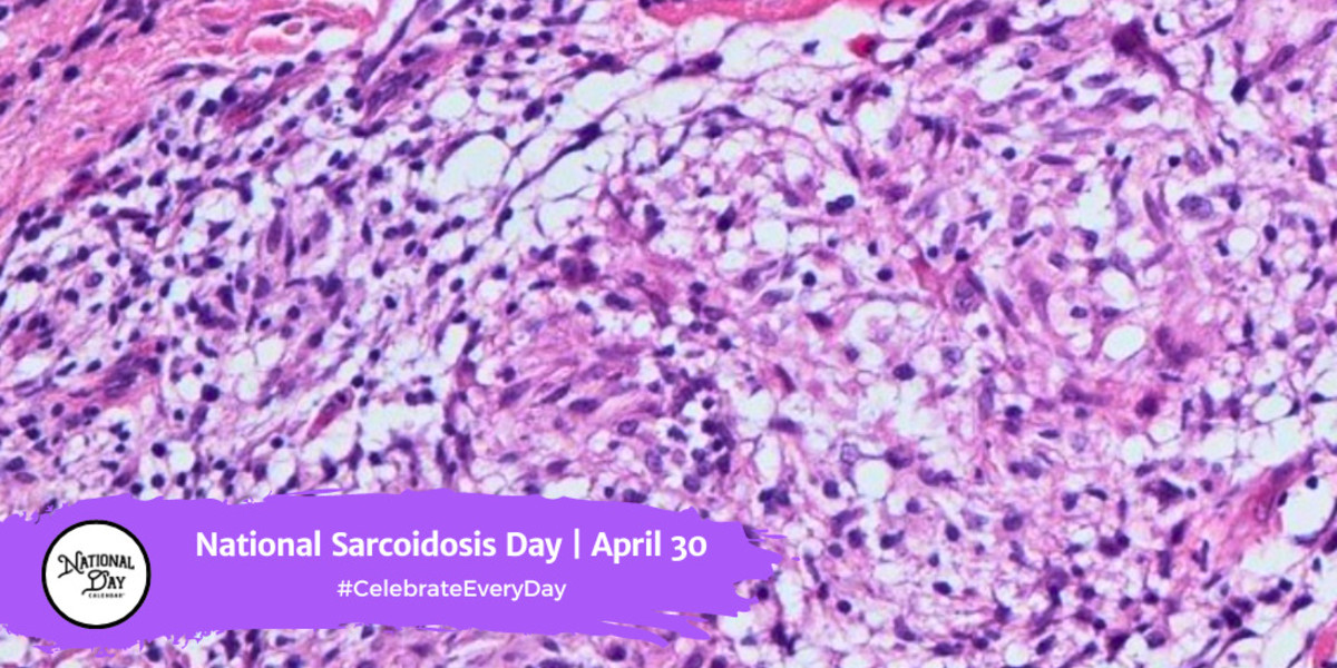 National Sarcoidosis Day | April 30
